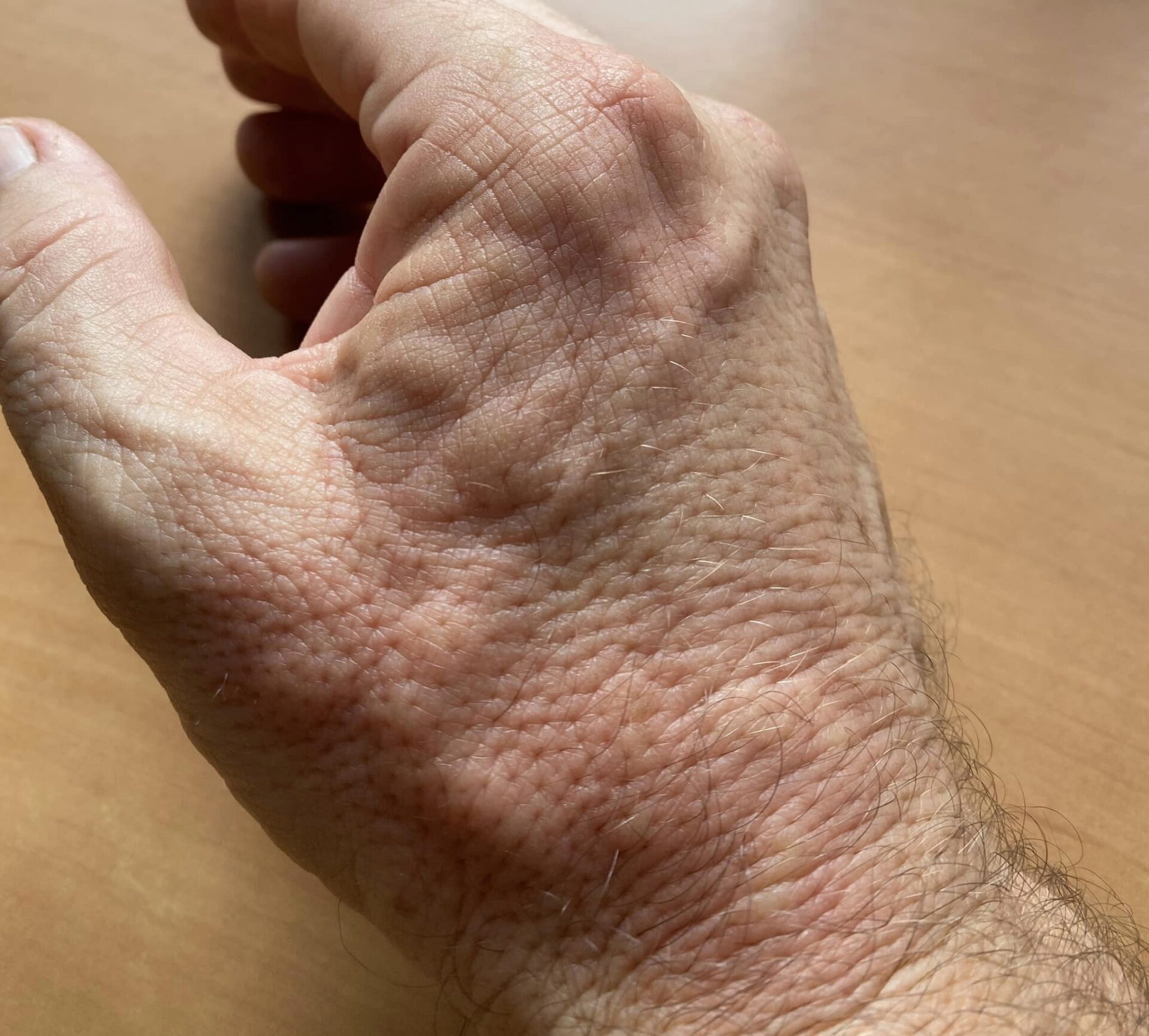 The tree with a painful sting that grows in our towns